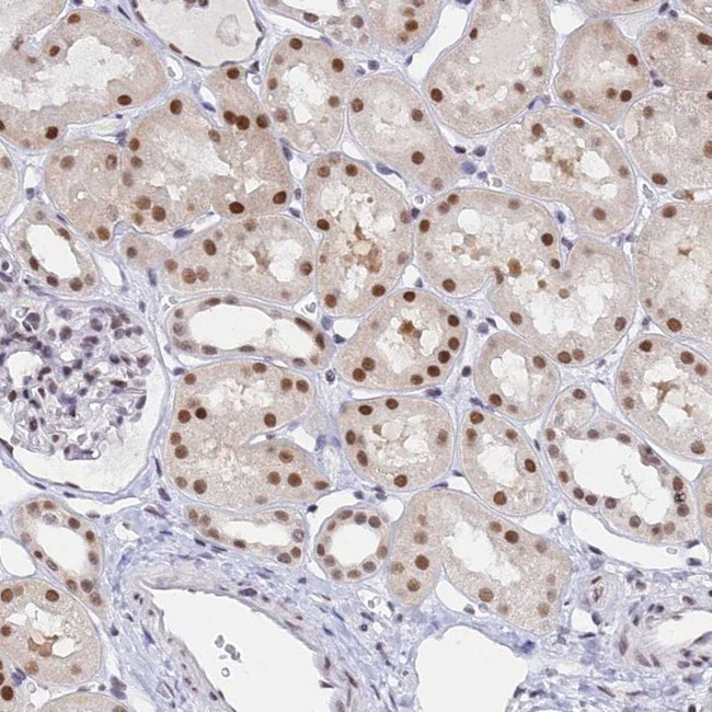 DPY30 Antibody in Immunohistochemistry (IHC)