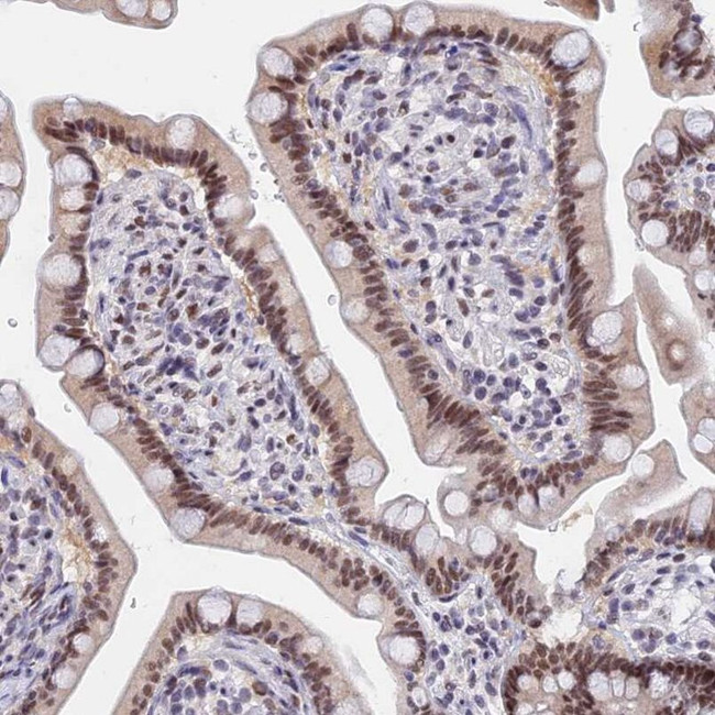 DPY30 Antibody in Immunohistochemistry (IHC)