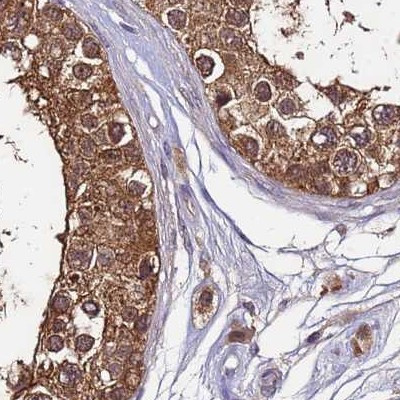 APOA1BP Antibody in Immunohistochemistry (IHC)