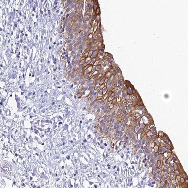 ZXDB Antibody in Immunohistochemistry (IHC)