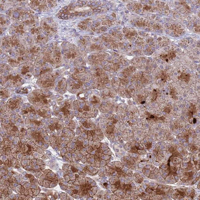 ACAD8 Antibody in Immunohistochemistry (IHC)