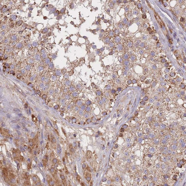 PTPMT1 Antibody in Immunohistochemistry (IHC)