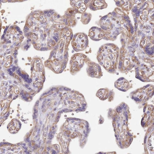 DOCK9 Antibody in Immunohistochemistry (IHC)