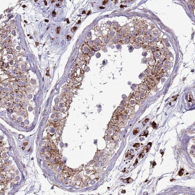 VPS36 Antibody in Immunohistochemistry (IHC)