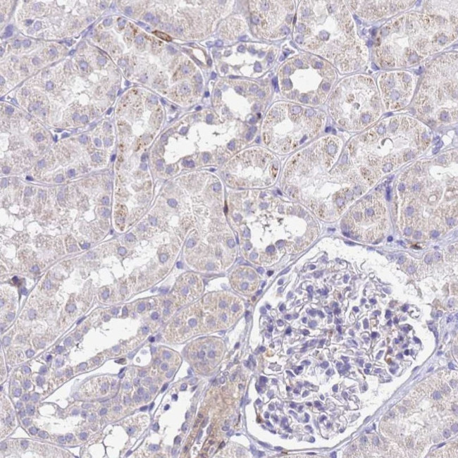 DBNDD2 Antibody in Immunohistochemistry (IHC)