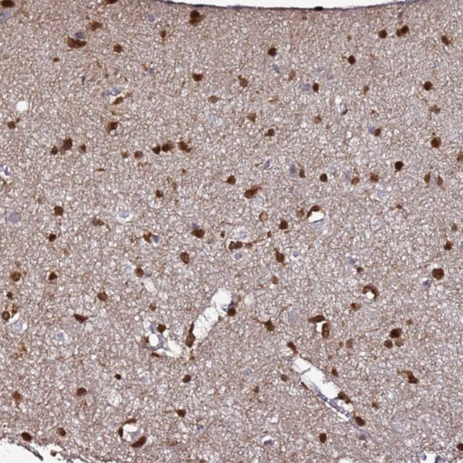 DBNDD2 Antibody in Immunohistochemistry (IHC)