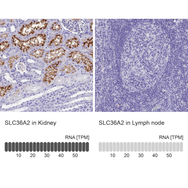 SLC36A2 Antibody in Immunohistochemistry (IHC)