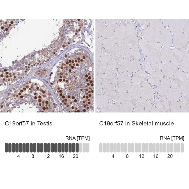 C19orf57 Antibody in Immunohistochemistry (IHC)