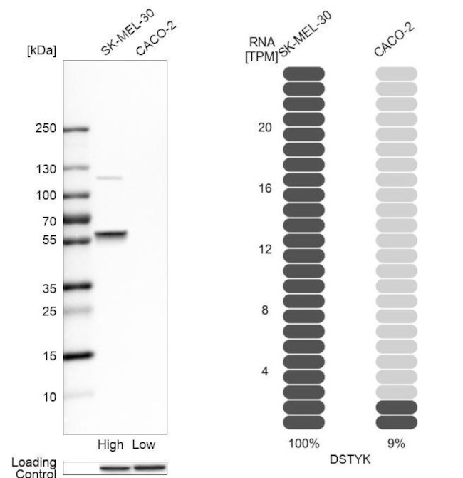 RIPK5 Antibody