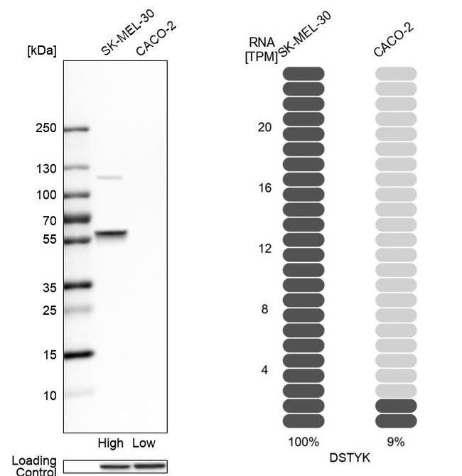 RIPK5 Antibody in Western Blot (WB)