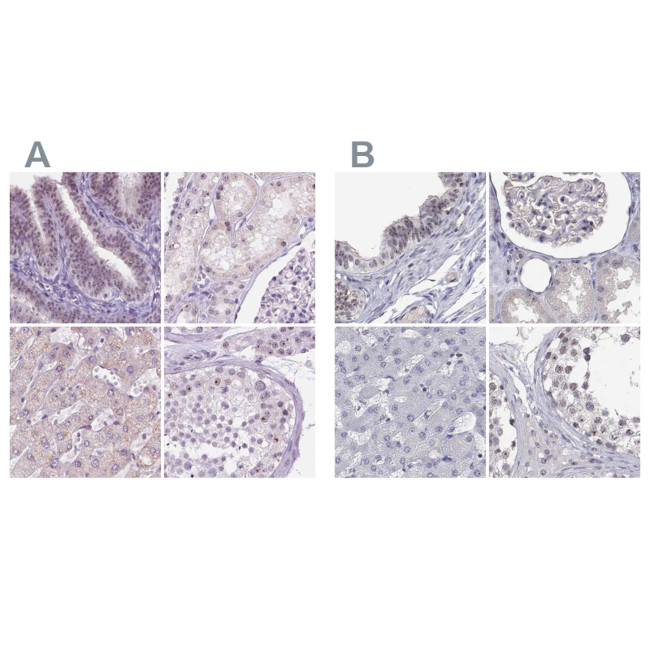 NHP2 Antibody in Immunohistochemistry (IHC)