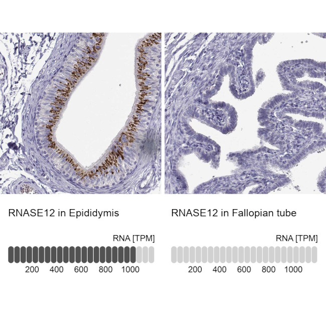 RNase12 Antibody in Immunohistochemistry (IHC)