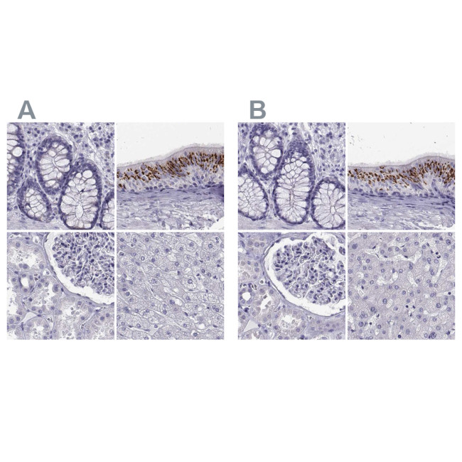 RNase12 Antibody in Immunohistochemistry (IHC)