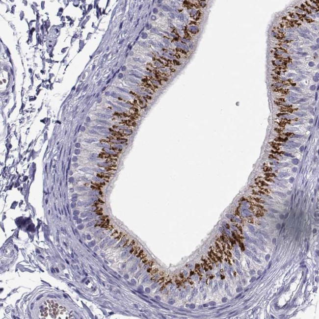 RNase12 Antibody in Immunohistochemistry (IHC)