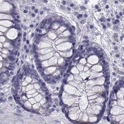 RNase12 Antibody in Immunohistochemistry (IHC)