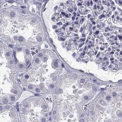 RNase12 Antibody in Immunohistochemistry (IHC)