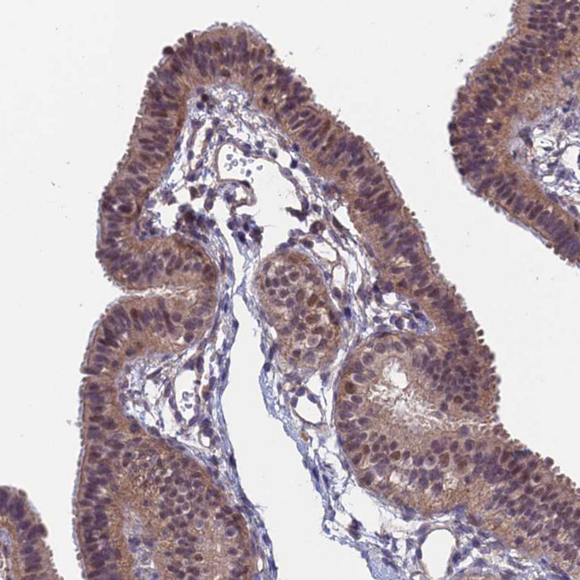 SDOS Antibody in Immunohistochemistry (IHC)