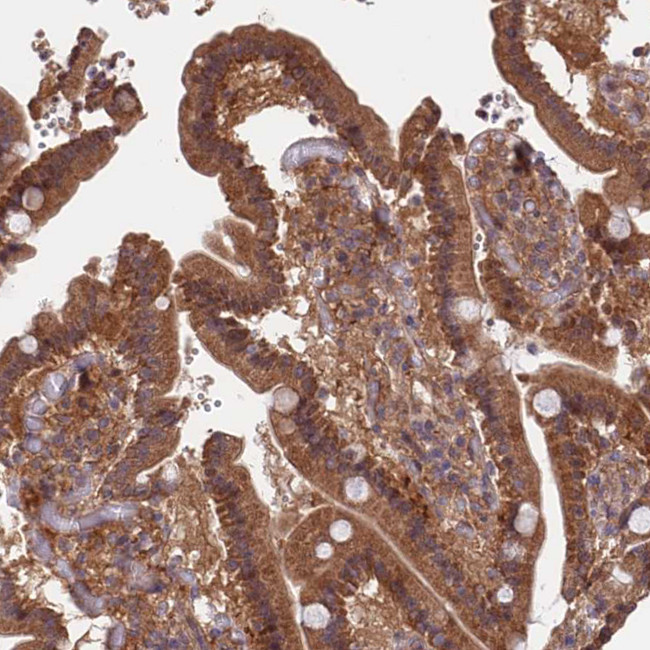 SDOS Antibody in Immunohistochemistry (IHC)