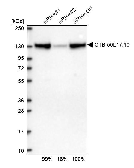 HDGFRP2 Antibody