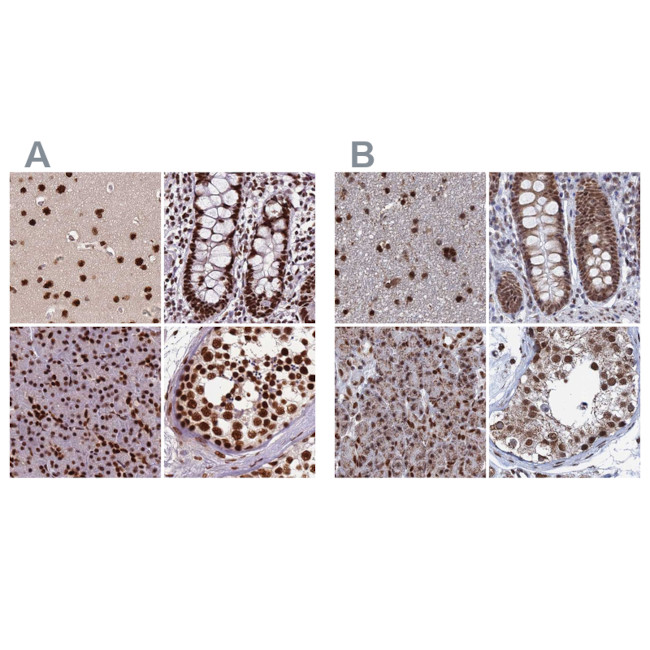 HDGFRP2 Antibody in Immunohistochemistry (IHC)