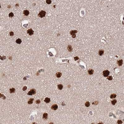 HDGFRP2 Antibody in Immunohistochemistry (IHC)