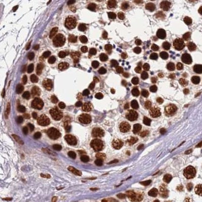 HDGFRP2 Antibody in Immunohistochemistry (IHC)