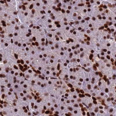 HDGFRP2 Antibody in Immunohistochemistry (IHC)