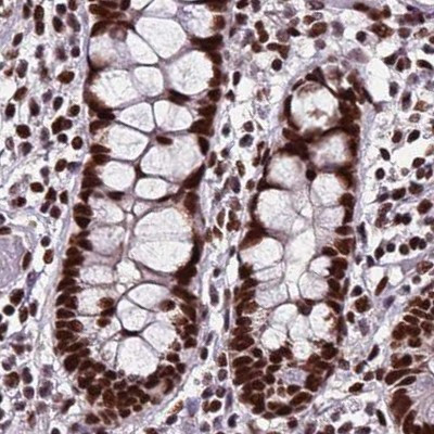 HDGFRP2 Antibody in Immunohistochemistry (IHC)