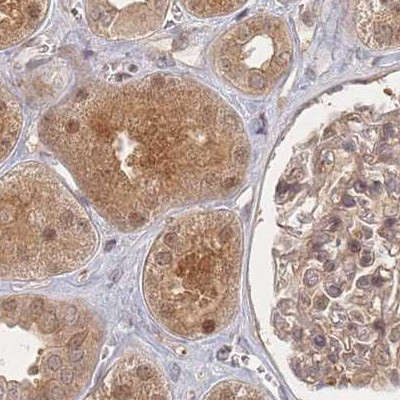 PSMD9 Antibody in Immunohistochemistry (IHC)