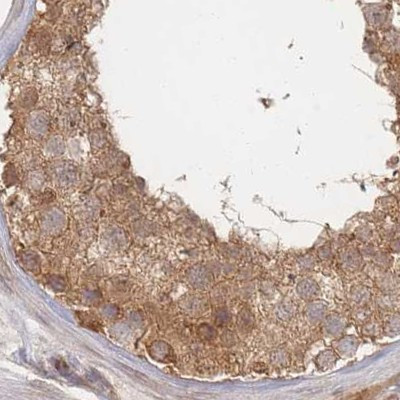 PSMD9 Antibody in Immunohistochemistry (IHC)