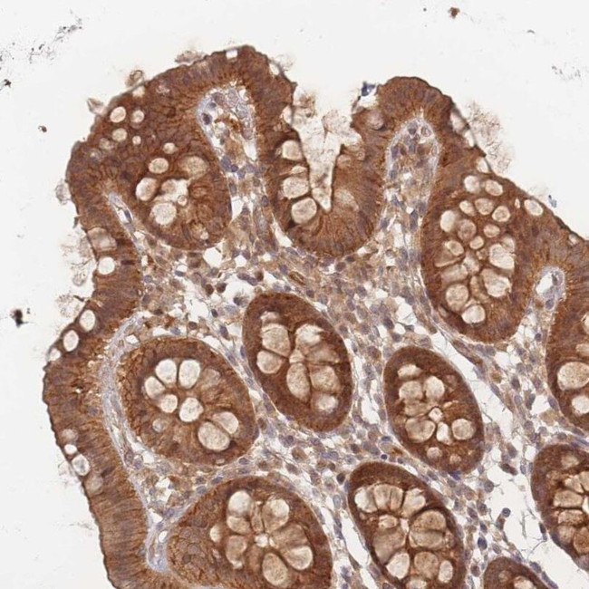 PSMD9 Antibody in Immunohistochemistry (IHC)