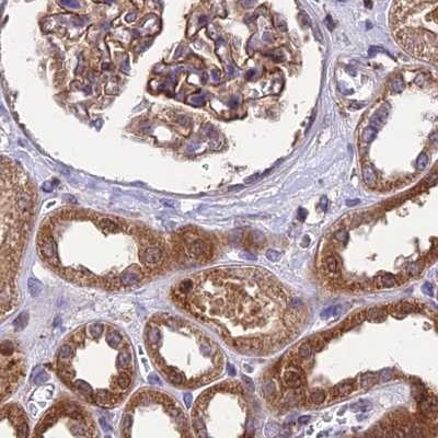 MKKS Antibody in Immunohistochemistry (IHC)