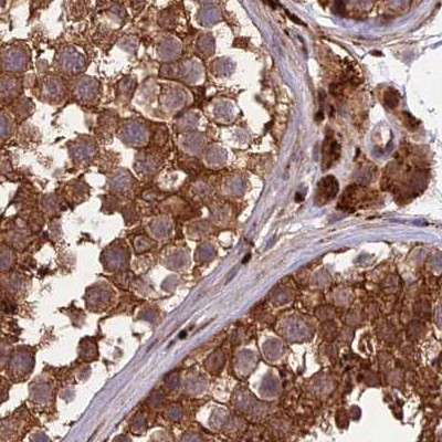 MKKS Antibody in Immunohistochemistry (IHC)