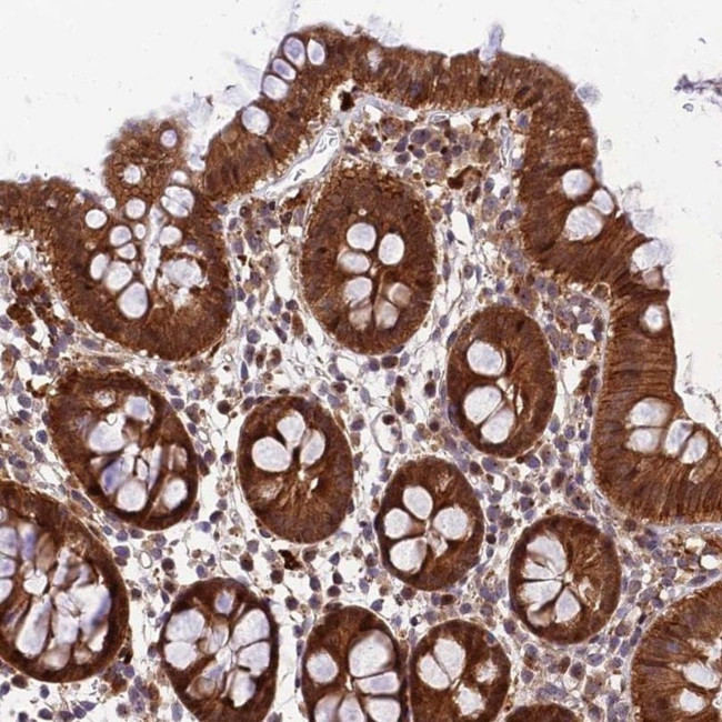 MKKS Antibody in Immunohistochemistry (IHC)