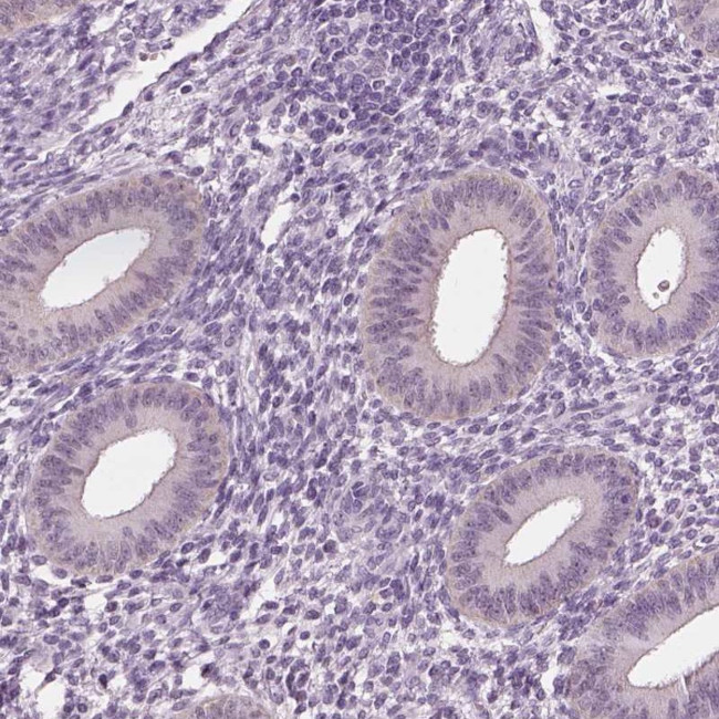 ELSPBP1 Antibody in Immunohistochemistry (IHC)