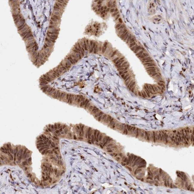 SBP2 Antibody in Immunohistochemistry (IHC)