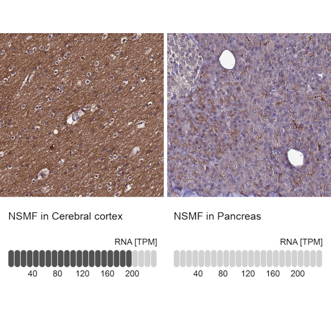 NELF Antibody in Immunohistochemistry (IHC)