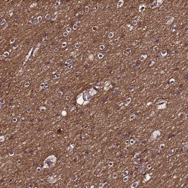 NELF Antibody in Immunohistochemistry (IHC)