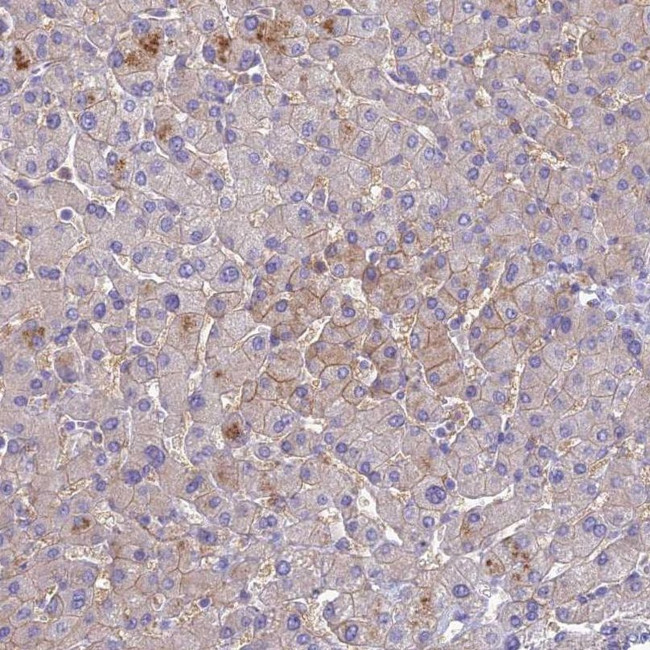 SLC13A5 Antibody in Immunohistochemistry (IHC)