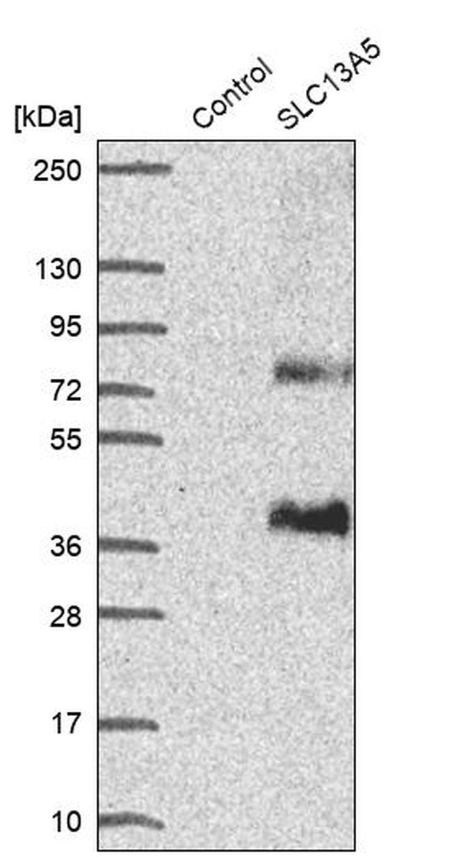 SLC13A5 Antibody in Western Blot (WB)