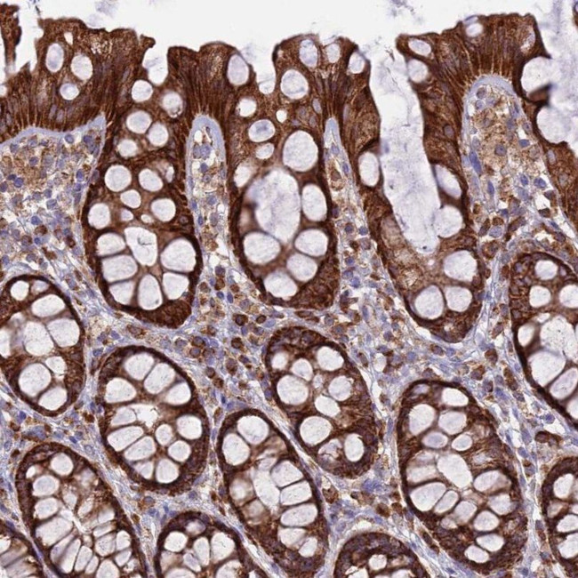 UAP1L1 Antibody in Immunohistochemistry (IHC)