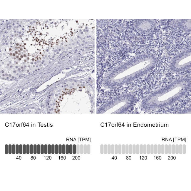 C17orf64 Antibody in Immunohistochemistry (IHC)