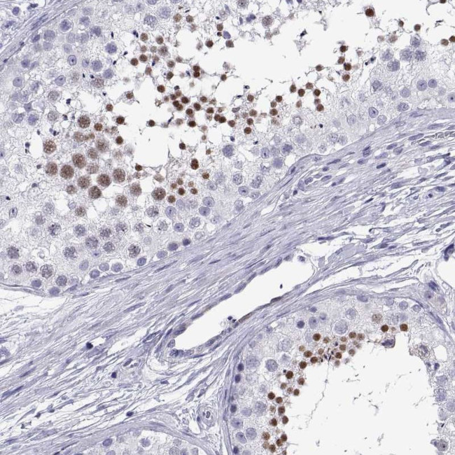 C17orf64 Antibody in Immunohistochemistry (IHC)