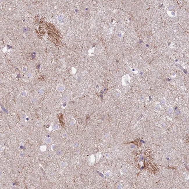 KVbeta1 (KCNAB1) Antibody in Immunohistochemistry (IHC)