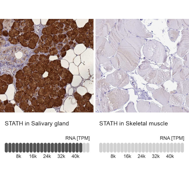 STATH Antibody in Immunohistochemistry (IHC)