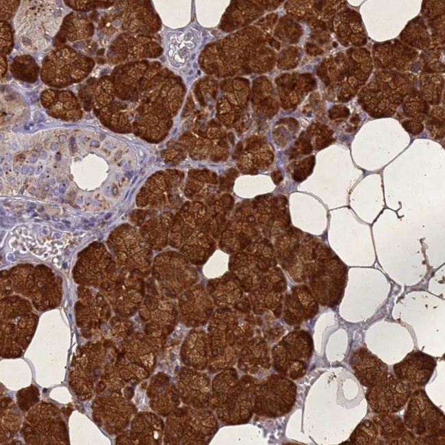 STATH Antibody in Immunohistochemistry (IHC)