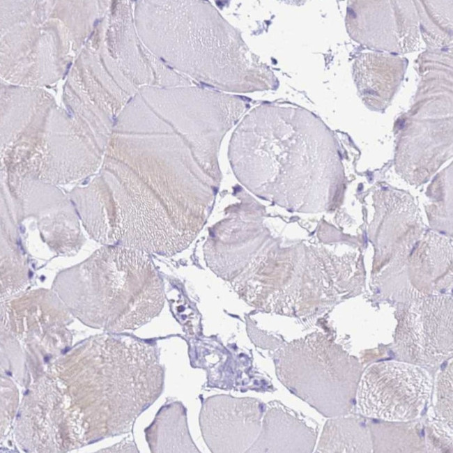 STATH Antibody in Immunohistochemistry (IHC)