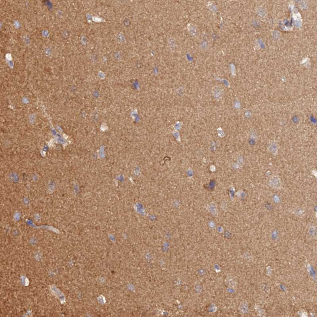 HINT1 Antibody in Immunohistochemistry (IHC)