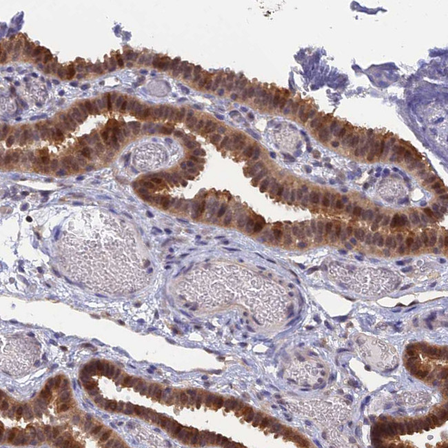 HINT1 Antibody in Immunohistochemistry (IHC)