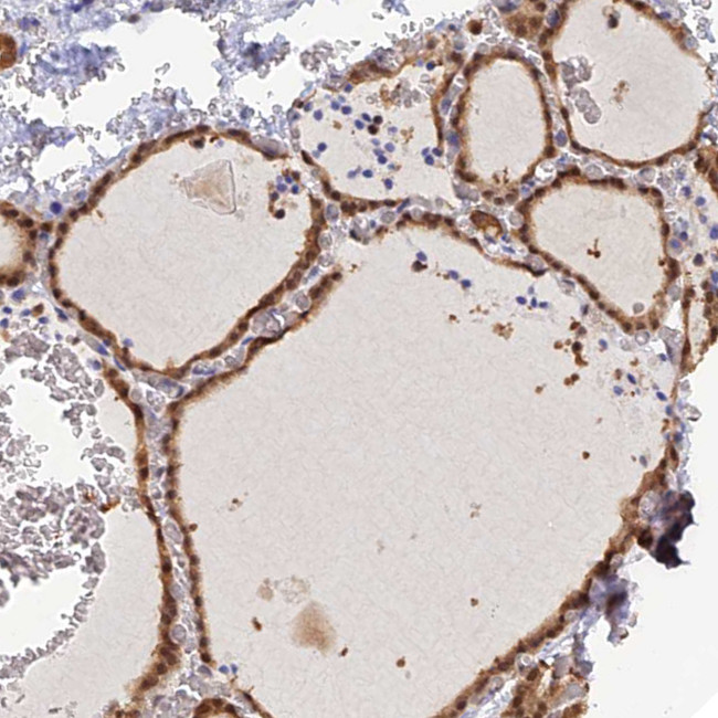 HINT1 Antibody in Immunohistochemistry (IHC)